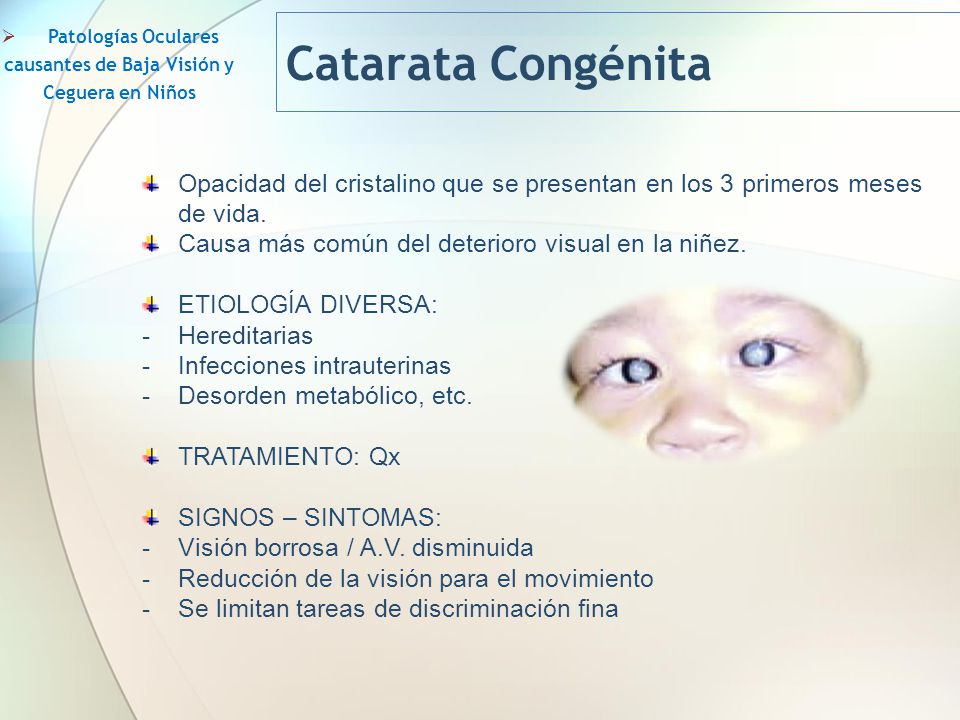 Causas de las cataratas congenitas